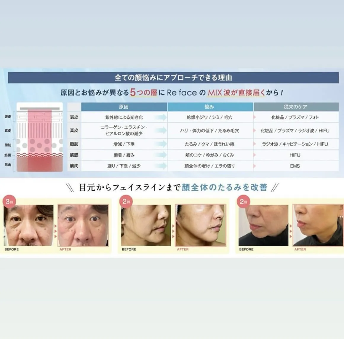 #美容貯金 #予防美容
